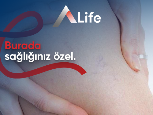 Antifosfolipid Sendromu (APS)